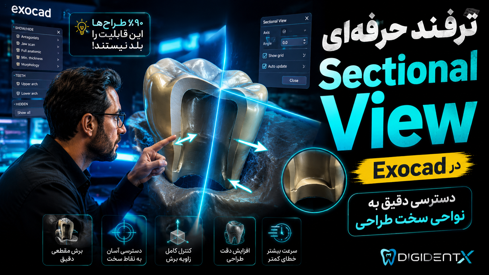آموزش Sectional View در Exocad