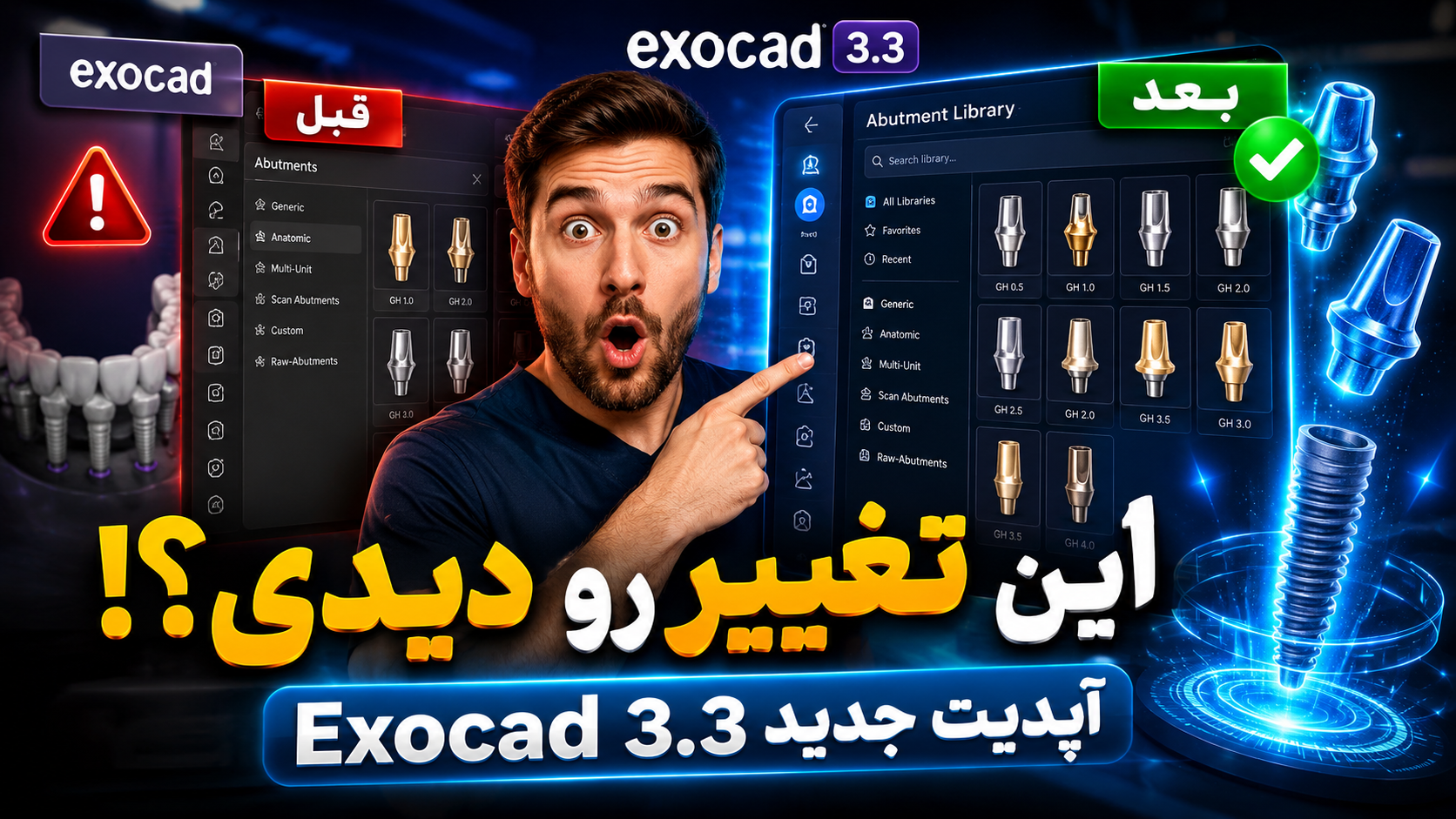 تغییرات جدید بخش Abutment Library در Exocad 3.3