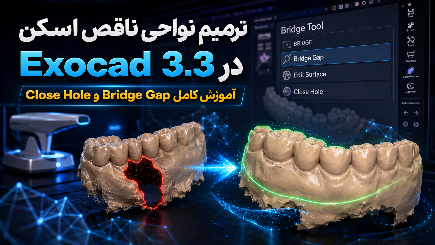 آموزش ترمیم نواحی ناقص اسکن در Exocad 3.3 با ابزار Bridge