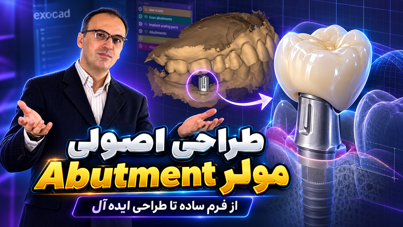 طراحی اصولی Abutment مولر؛ Emergence Profile، Retention و مدیریت بافت نرم