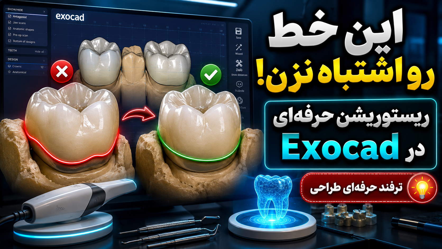 چگونه مارجین ریستوریشن را در Exocad به‌درستی اصلاح کنیم؟