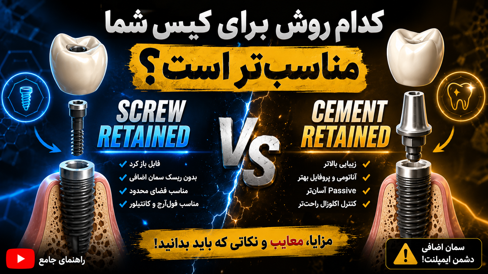 رستوریشن ایمپلنت با پیچ یا سمان؛ Screw-Retained یا Cement-Retained؟