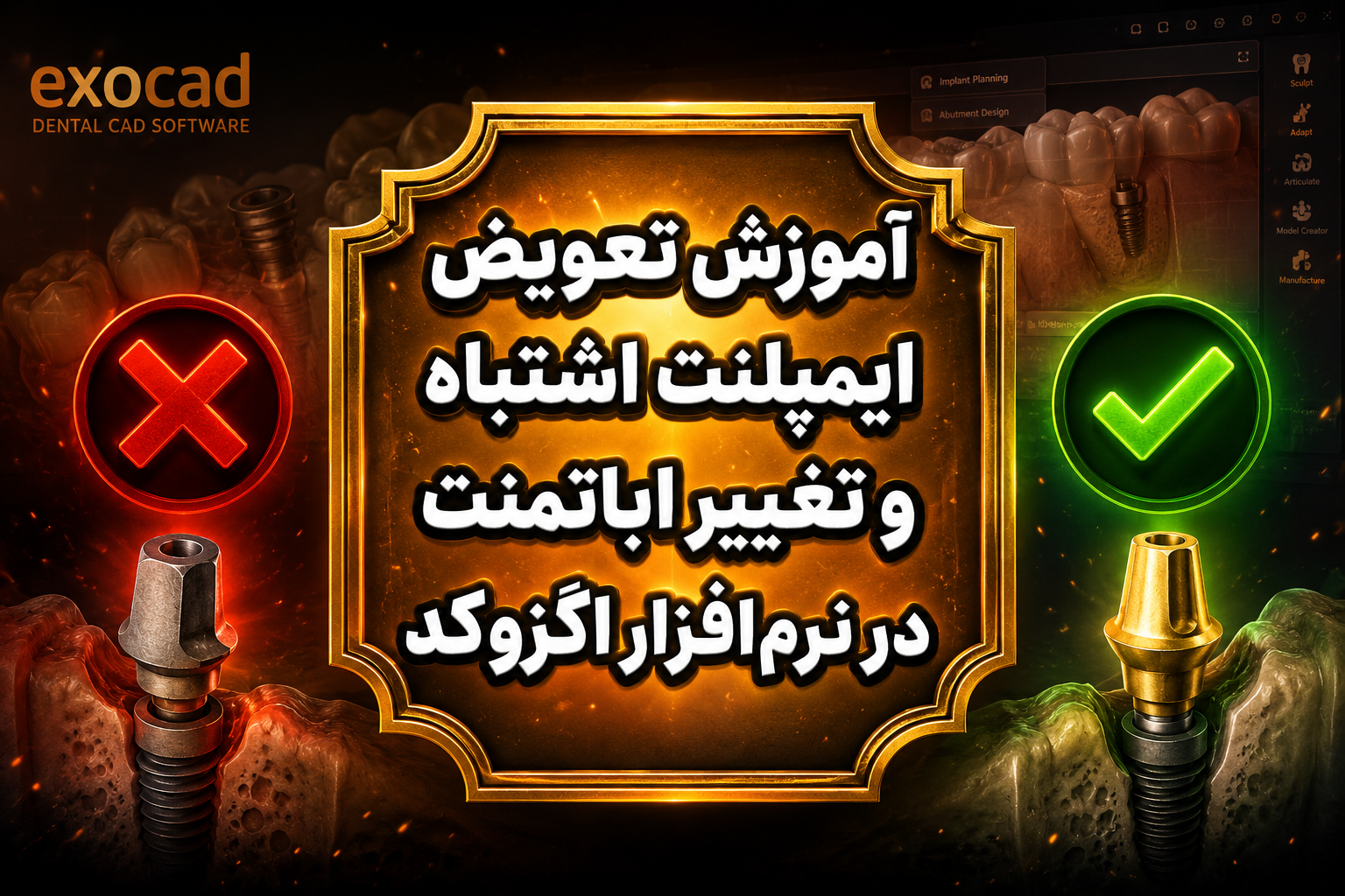 آموزش تعویض ایمپلنت اشتباه و تغییر اباتمنت در نرم‌افزار اگزوکد
