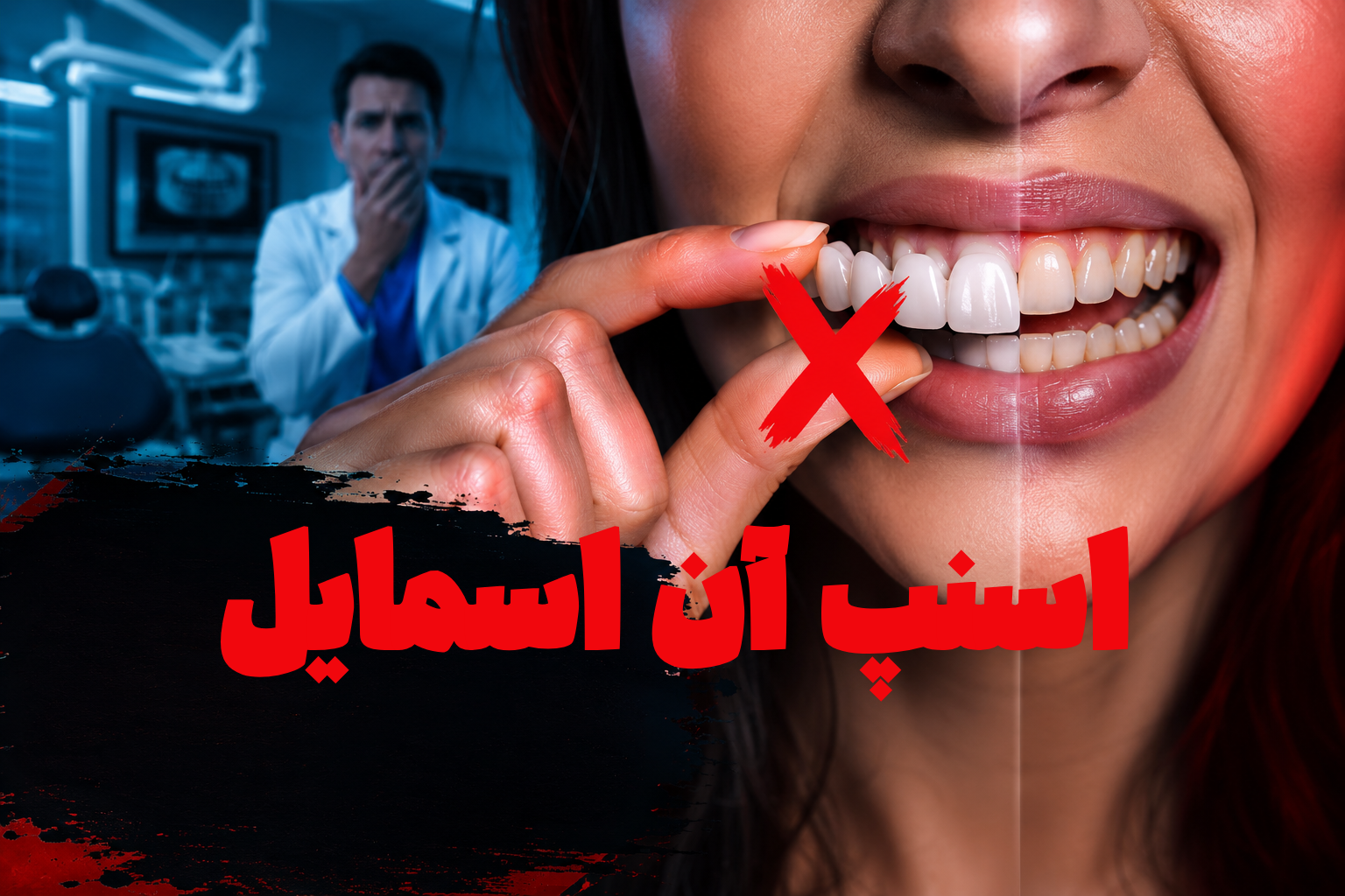 اسنپ آن اسمایل (Snap on Smile) چیست؟