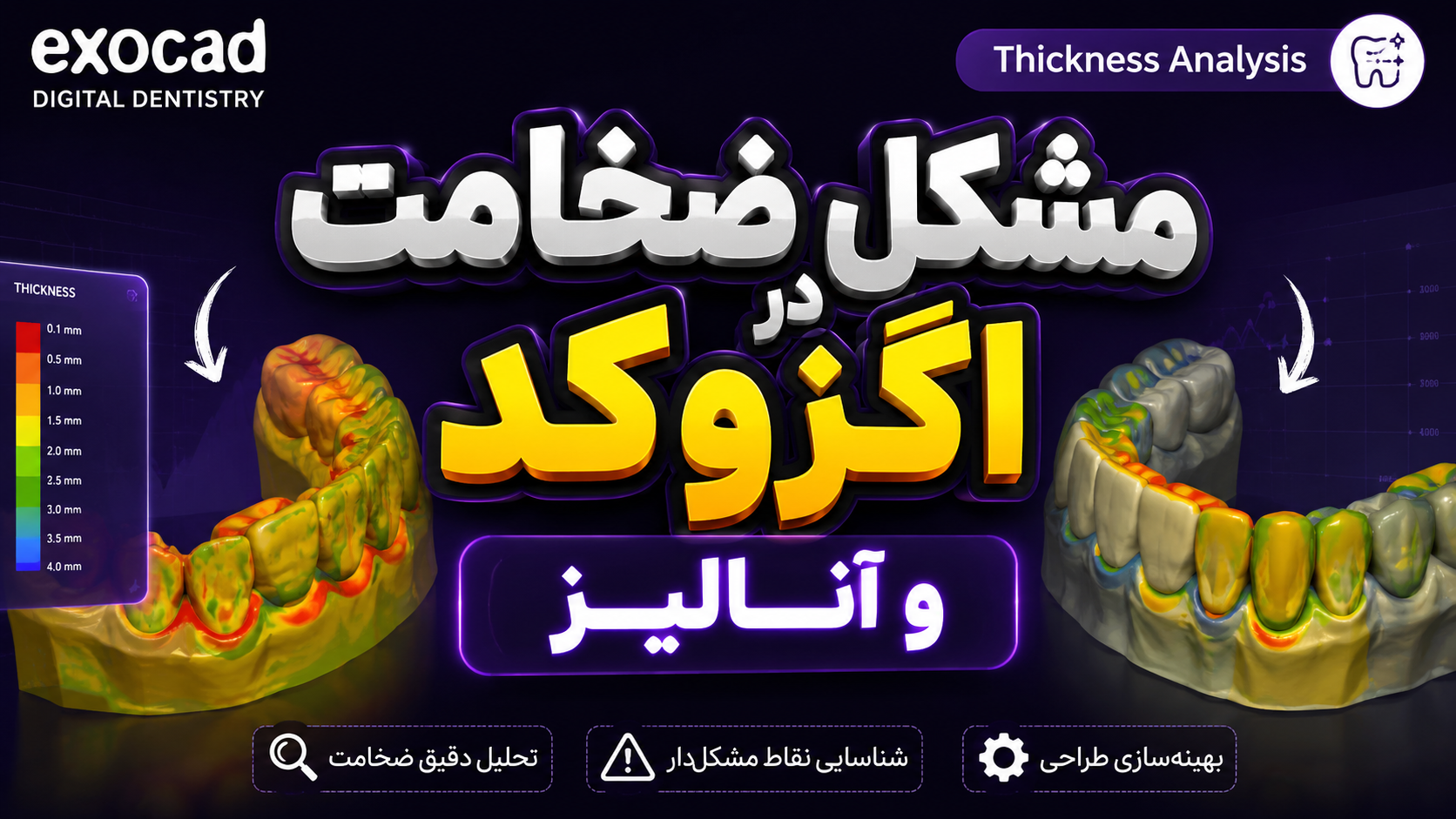 آنالیز ضخامت (Thickness Analysis) exocad