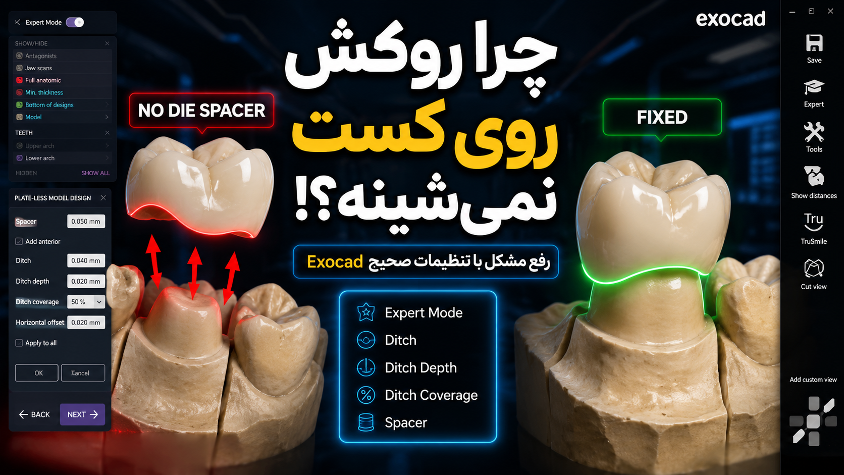 چرا روکش روی کست نمی‌نشیند؟ آموزش رفع مشکل Die Spacer در Exocad