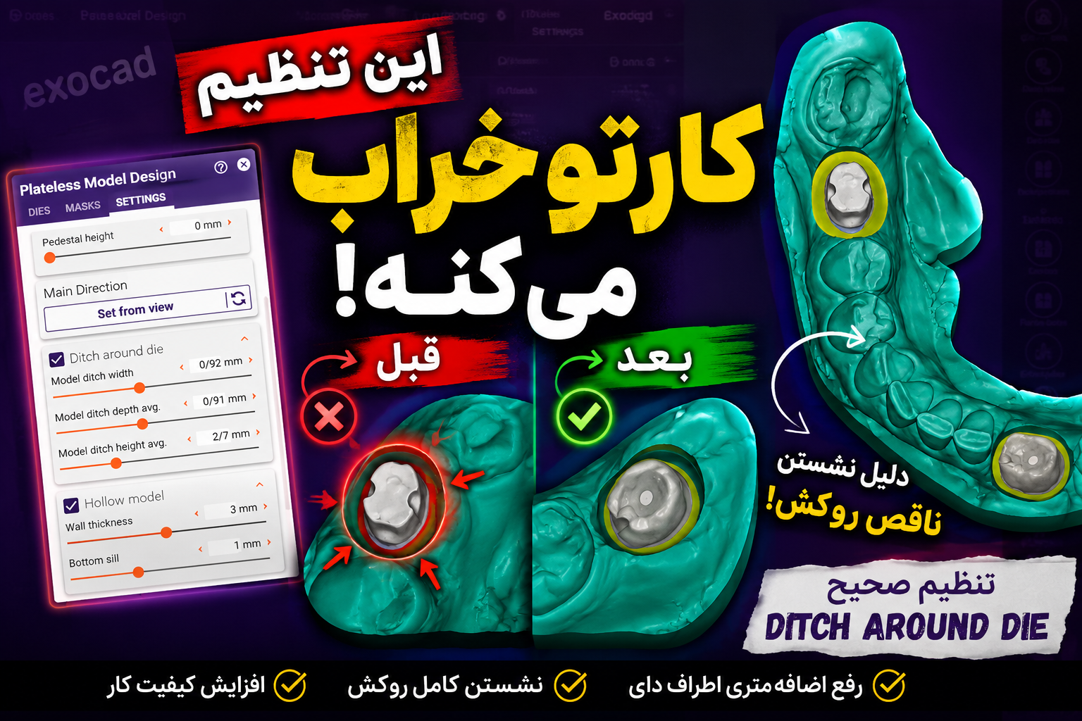 بررسی تنظیمات Die Spacer و Ditch Around Die در Exocad