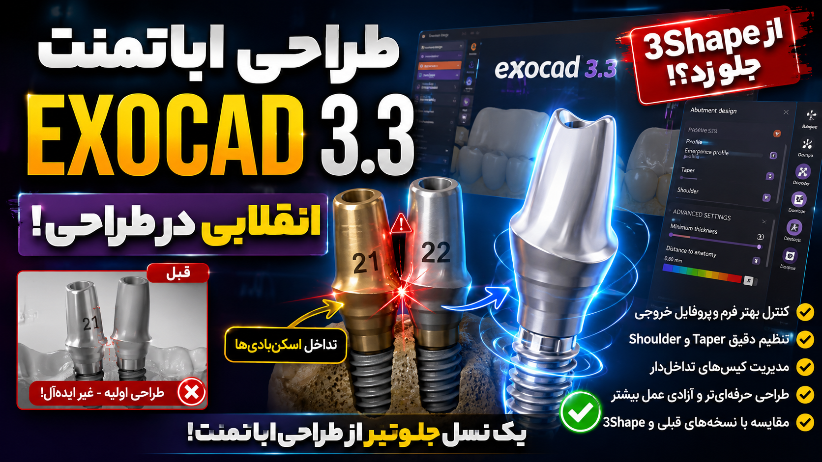 طراحی اباتمنت در Exocad 3.3؛ یک جهش بزرگ در دیجیتال دنتیستری