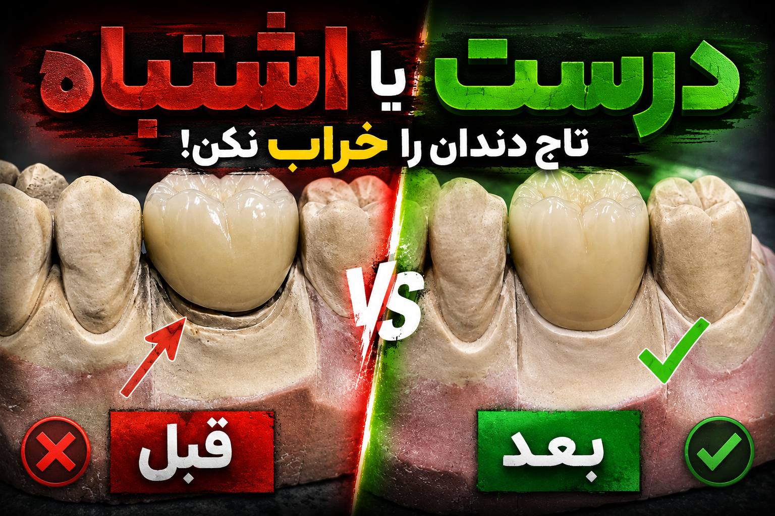 نقش پیوستگی در ناحیه سرویکال بر ماندگاری رستوریشن‌های دندانی